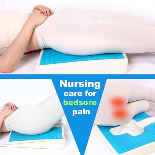41ouapzeerl.jpg Gel Wheelchair Seat Cushion for Back and Coccyx Pain Relief (Blue) | Ergonomic Chair Cushion with Anti-Slip Cover for S