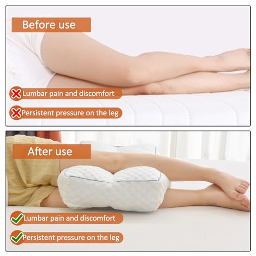 41r pq51dql 1.jpg Gehannah Foam Knee Pillow for Side Sleepers, Spinal Alignment, Pregnancy Support, Back Pain Relief, 5.5" Leg Pillow 2