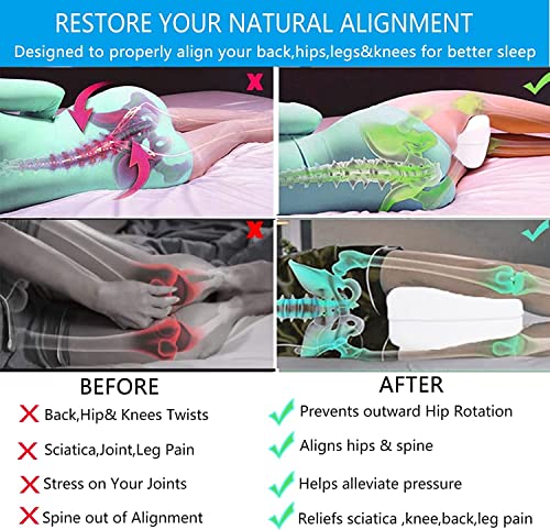 51c4wmbt8cl.jpg Leg Pillow, Knee Pillow for Side Sleepers, Relieving Leg and Back Pain for Better Sleep | Leg Pillow, Knee Cushion f